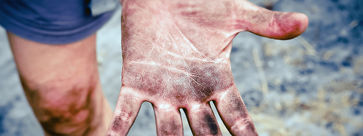 汚れた手のひら